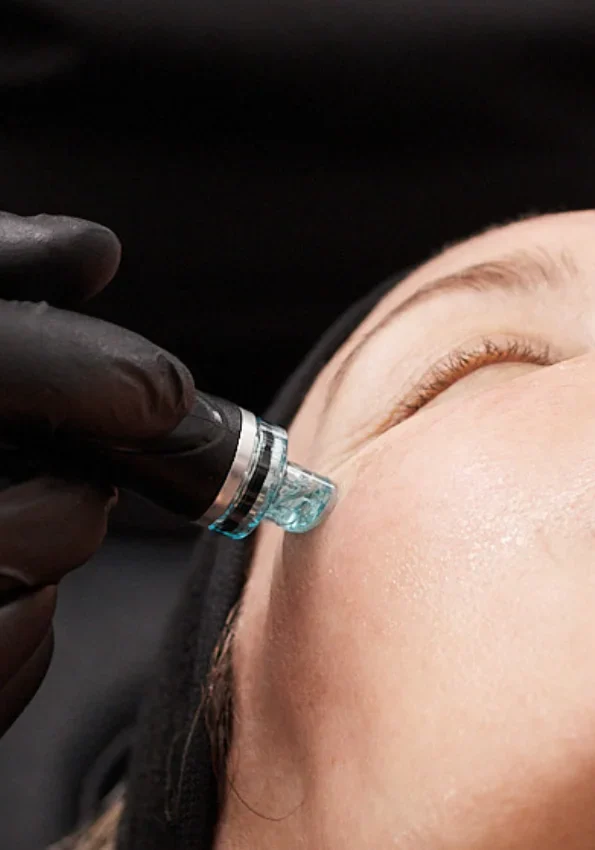 7_Steps_Peel_Image_Left_Side_Test