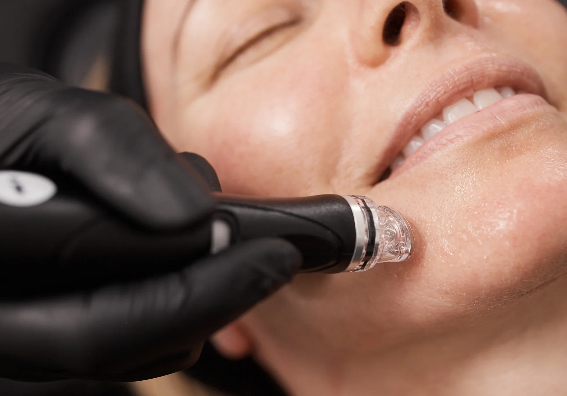 baf4626b145ba0d54ddd7641cfe3d9dcc525e286